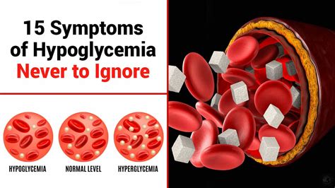 How To Get Rid Of Hypoglycemia Gameclass18