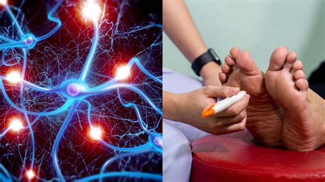 The Guide To Neuropathy
