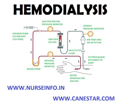 Hemodialysis Nurse Info