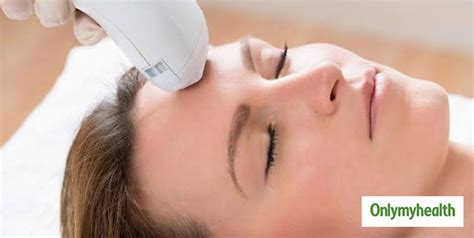 What Is Photofacial Skin Treatment Know The Types