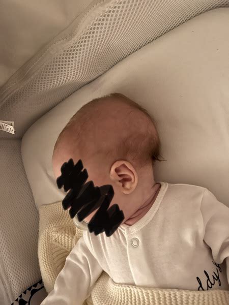 Baby Head Shape Mumsnet
