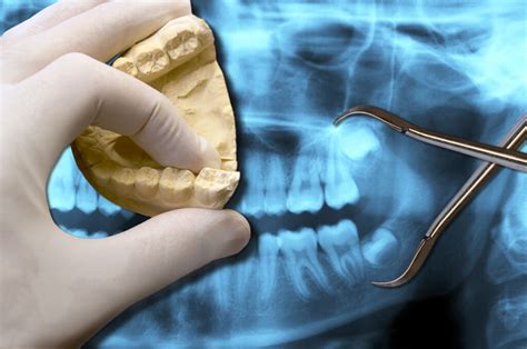 ¿cómo Funciona La Radiología Digital Clinica Dental Doblas