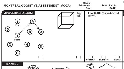 July 31st marks harry potter's birthday Moca Scoring Nuances With Clock Draw / The Clock Drawing Test A Cognitive Screening Tool ...