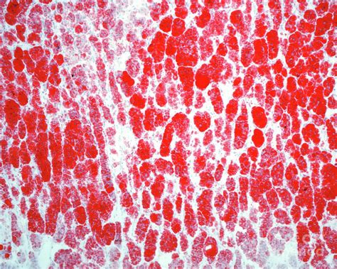 Adrenal Gland Cortex Photograph By Jose Calvo Science Photo Library