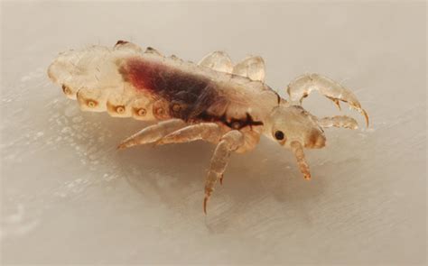 Choosing Head Lice And Nit Treatments Which