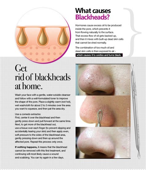 Use a clay mask two to three times a week. Pore Beauty Nose Pack (3 Step Blackhead Remover Only ...