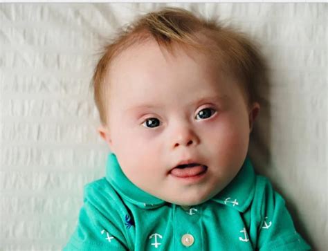 Iceland Murders Downs Syndrome Babies And Mourns The Loss Of A Glacier