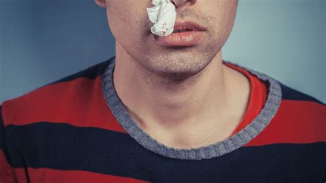 What Causes A Nosebleed Huffpost Uk Life