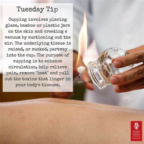 Tuesday Tip Cupping Therapy Has Many Benefits And Can Treat Many Conditions Cupping Therapy