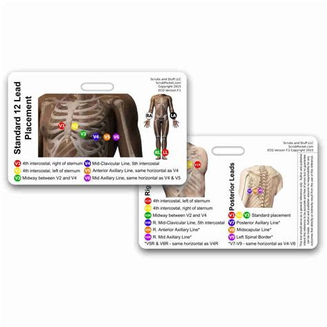 12 Lead Ekg Placement Card Horizontal Badge Reference Cards Code 1