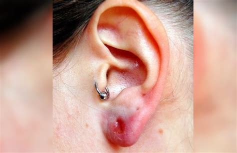 How To Cure A Piercing Infection Contestgold8