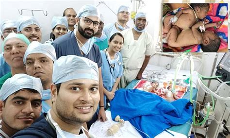Surgeons Share A Celebratory Selfie After Separating Conjoined Twins Daily Mail Online