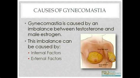 Causes Of Gynecomastia YouTube