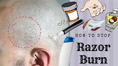 How To Stop Razor Bumpsburn Head Shave Youtube