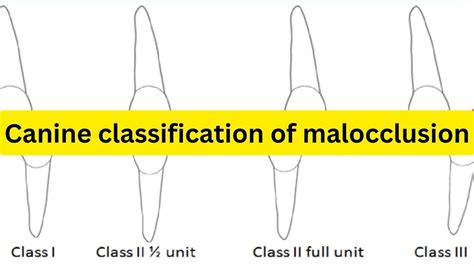 Canine Classification Of Malocclusion SIMPLIFIED YouTube