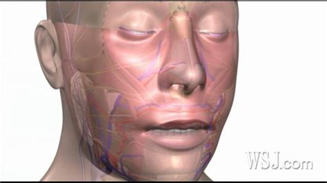 Doctors Perform Successful Face Transplant