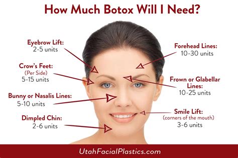 How Much Botox Will I Need Utah Facial Plastics