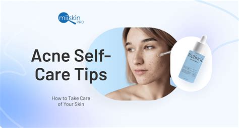 Acne Causes Treatment And Care Tips For Acne Prone Skin