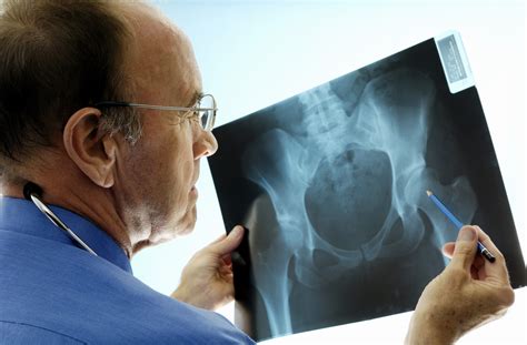 Orthopedic Surgeons 7 Things You Need To Know Penn Medicine