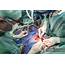 Surgeons Executing Heart Bypass Surgery — Team Patient  Stock Photo