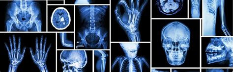 X Ray Explained Overview How Does It Work Why Is It Done