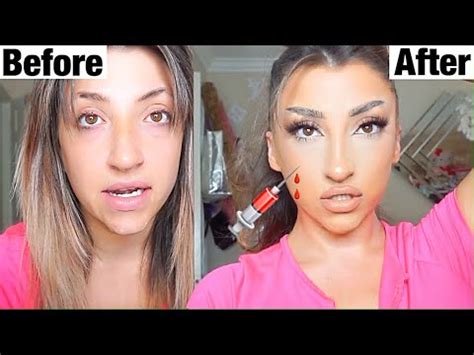 DIY PLASTIC SURGERY AT HOME YouTube