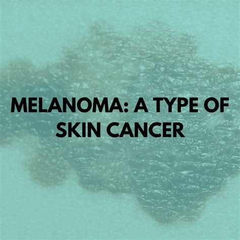 Melanoma A Type Of Skin Cancer