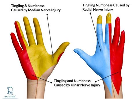 Ulnar Nervecoursemotorsensory And Common Injuries How To Relief