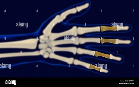 Falanges Medias De La Mano Skeleton Humano Anatomía Para El Concepto