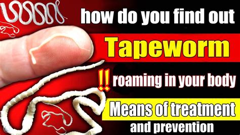 Signs That You Have Tapeworms Living Inyour Body How Do You Find Out Means Of Treatment