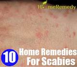Home Remedies Scabies Humans Pictures