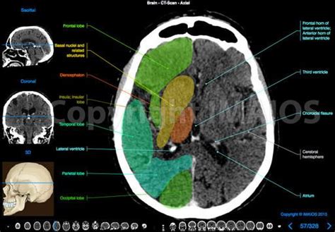 Brain And Face Ct Interactive Anatomy Atlas Interactive Anatomy