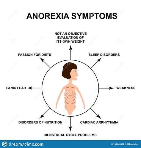 Anorexia Symptoms Slim Physique With Anorexia Infographics Vector