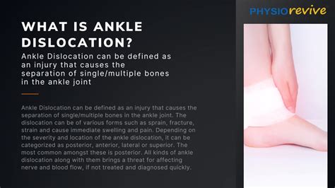 Ppt Physiotherapy And Ankle Dislocation Powerpoint Presentation Free