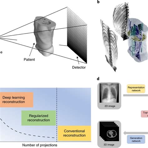 3d image reconstruction with ultra sparse projection view data a a download scientific diagram