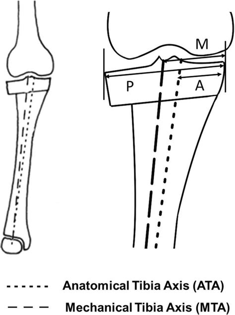 Definition Of Tibial Axis Deviation The Percentages Of Anatomical
