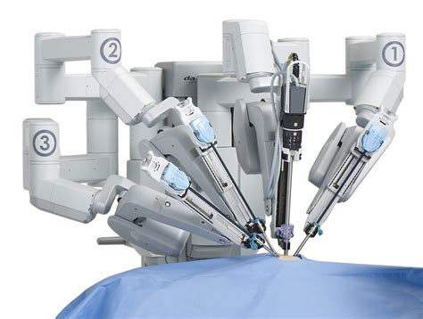 The Robot Assisted Surgery For Epilepsy That Changed On Mans Life