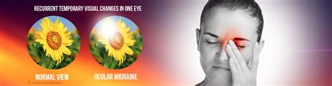 Retinal Ocular Eye Migraine Causes Symptoms Diagnosis