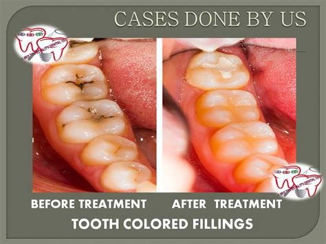 We did not find results for: Check out this photo | Emergency dental care, Dentist near ...