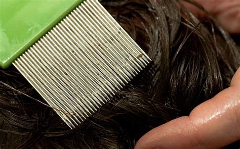 How To Spot Head Lice And Nits Which