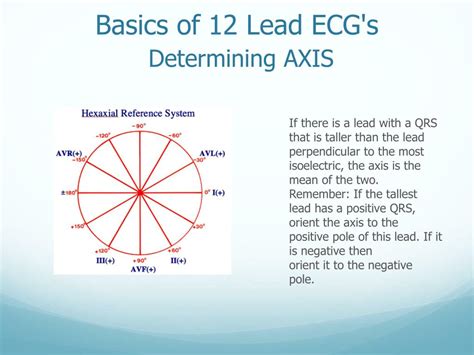 Ppt Determining Axis 12 Lead Ecgs Powerpoint Presentation Free