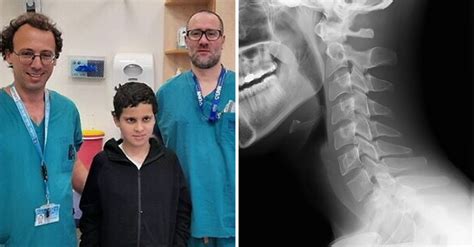 Doctors Successfully Reattach Boys Head After He Was Decapitated Vt