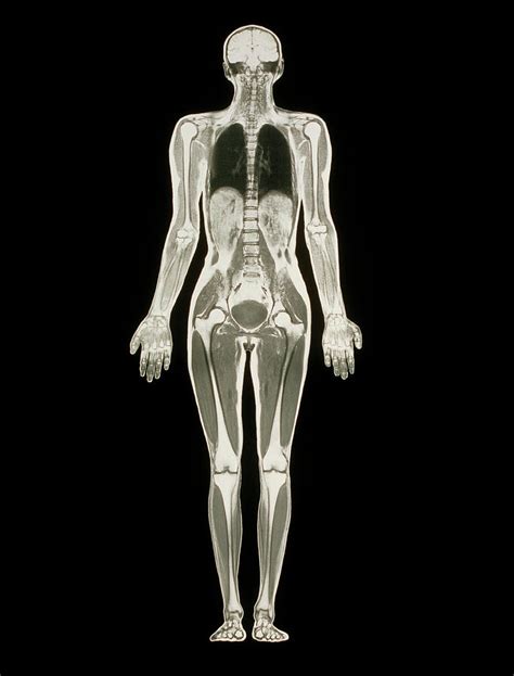 Mri Scan Of A Whole Human Body Female Photograph By