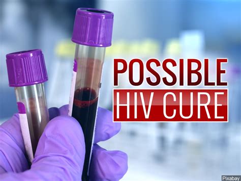 Stay informed about new developments on the aids/hiv front. Possible HIV Cure, Study Eliminates Virus in Mice - NBC ...