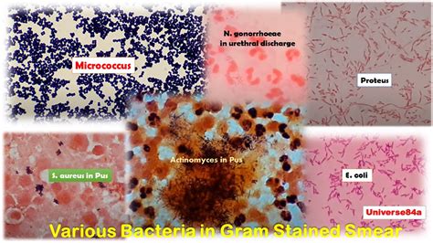 Gram Positive Streptococci