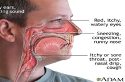 Common Causes Of Nasal Drip Vrogue