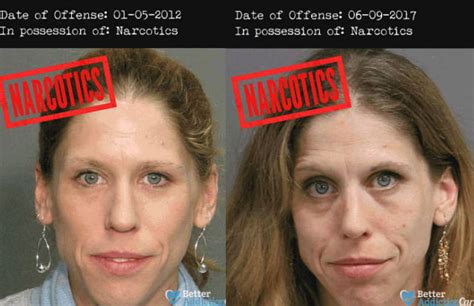 These Horrifying Mugshots Show The Real Effect Of Hard Drugs On Human