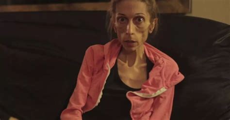 Woman Who Almost Died Of Anorexia Looks Unrecognisable After Her Incredible Recovery World