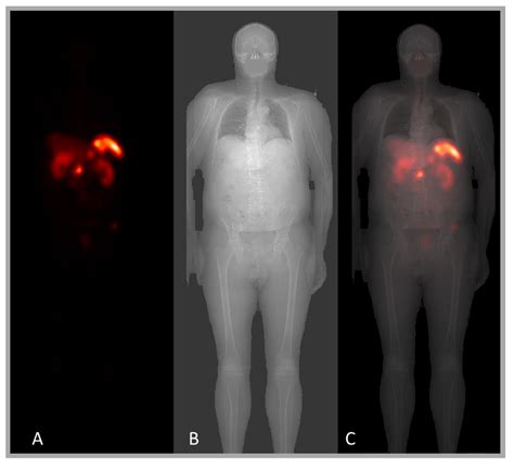 Diagnostics Free Full Text Hybrid Imaging For Patient Specific