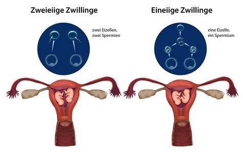 Eigentlich hatte sie „nur mit sieben babys gerechnet. Zwillingsschwangerschaft » Formen, Häufigkeit & Verlauf